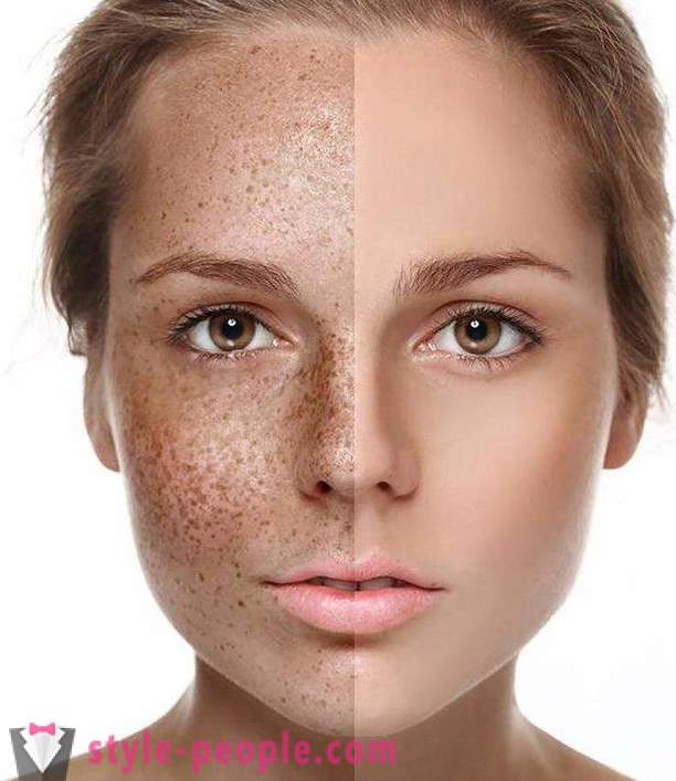 Hvordan bleke huden din hjemme?