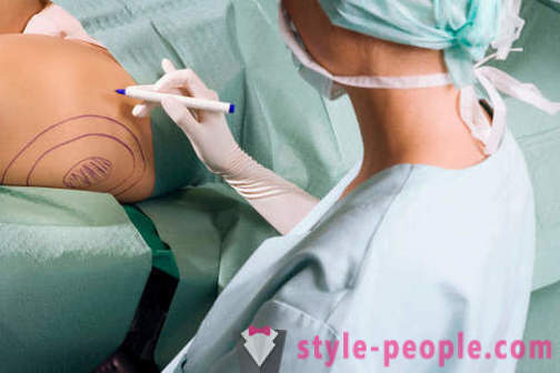 Plastiske kirurger ødelegge stereotypier om deres arbeid