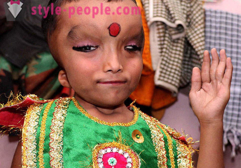 Den indiske landsbyen blir tilbedt gutt med et deformert hode som en gud Ganesha